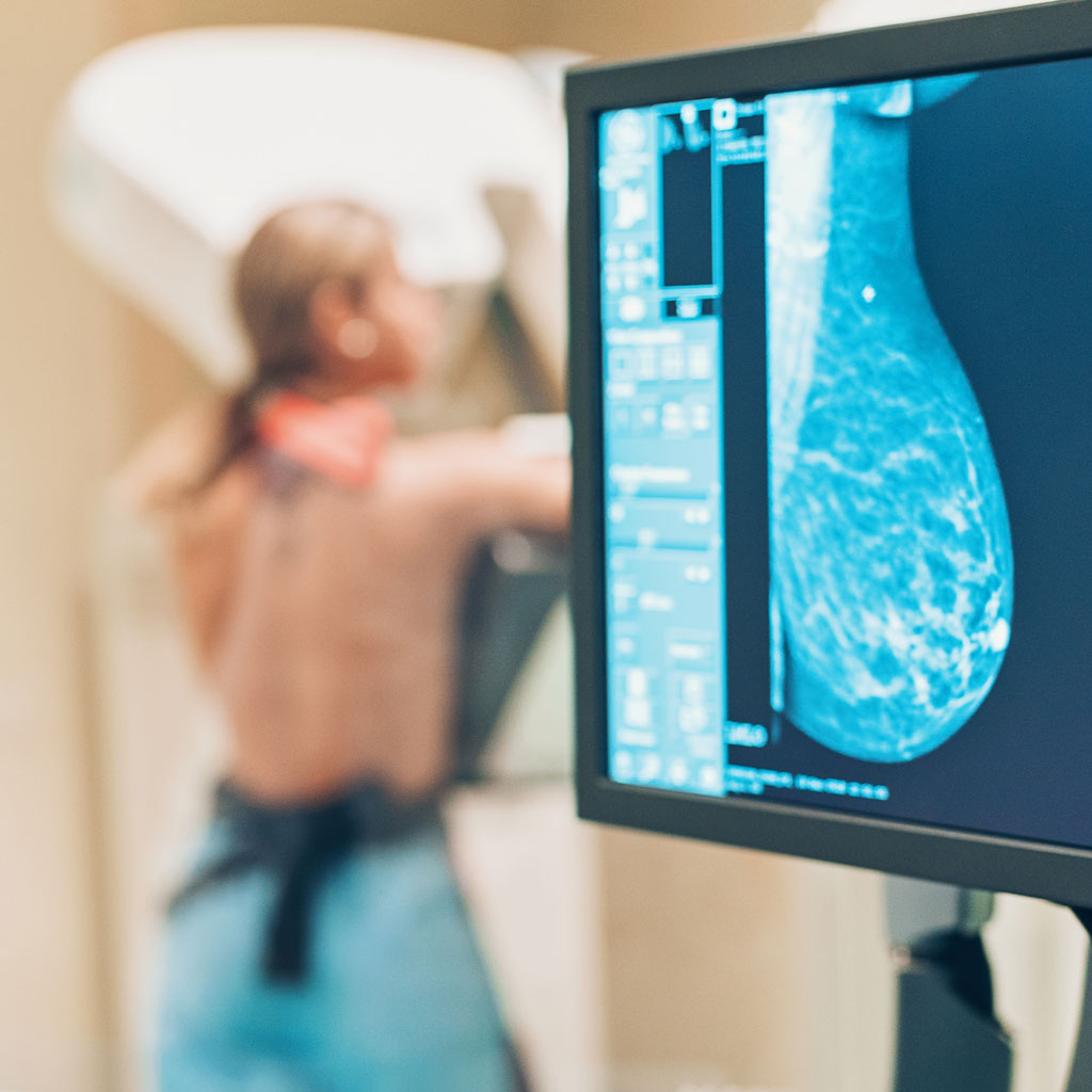 Mammogram Screen