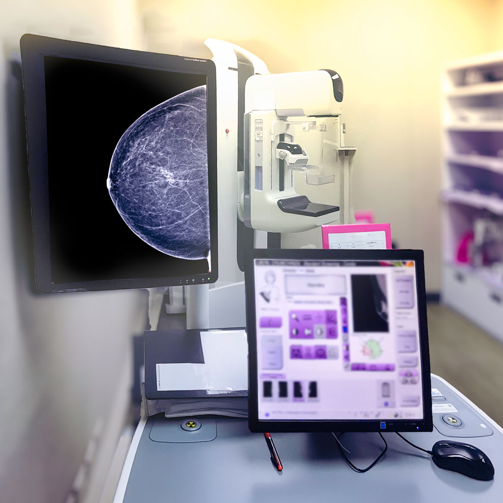 Mammography Equipment