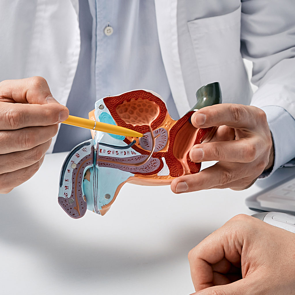 Doctor with Prostate Model